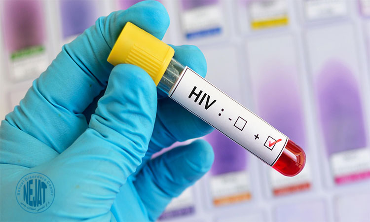 علائم بیماری مقاربتی HIV