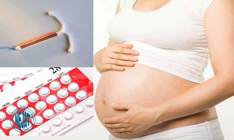 راه های پیشگیری از بارداری