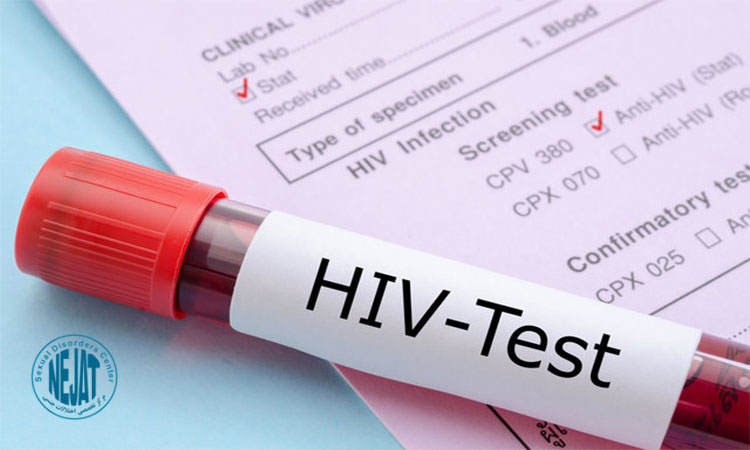 علائم hiv