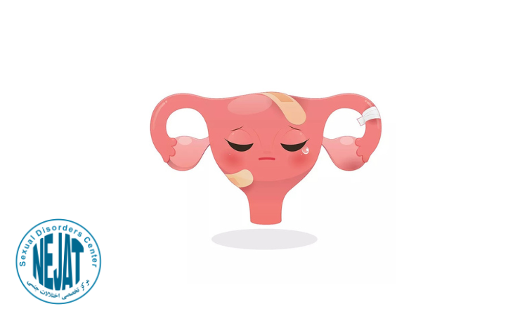 علائم و نشانه های تنبلی تخمدان در سنین باروری