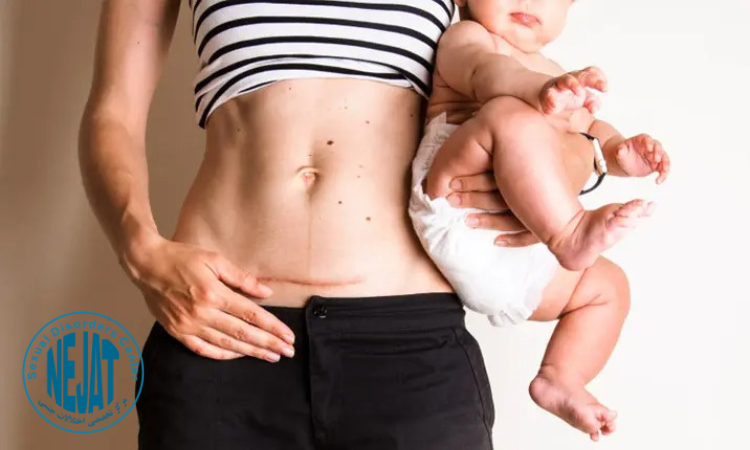 مزایا و فواید زایمان طبیعی نسبت به سزارین