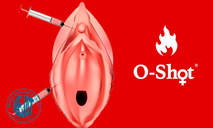 مزایا و کاربردهای تزریق اوشات در بهبود عملکرد جنسی و سلامت واژن